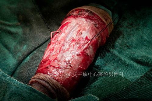 美阴茎图片,美阴茎图片解析